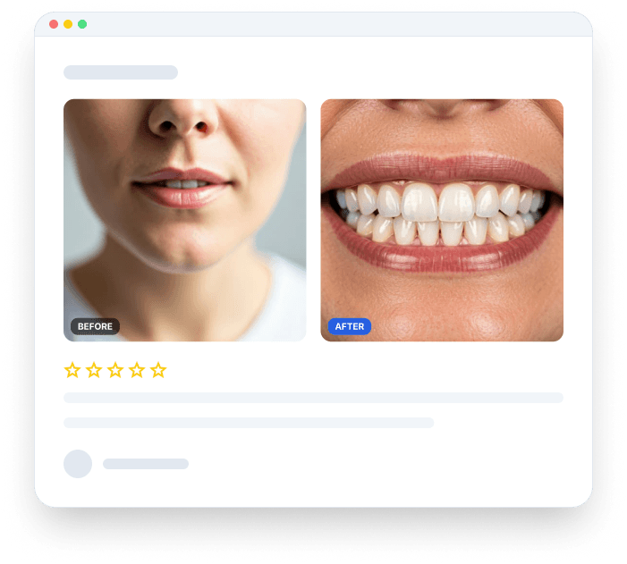 Before & After transformations mockup